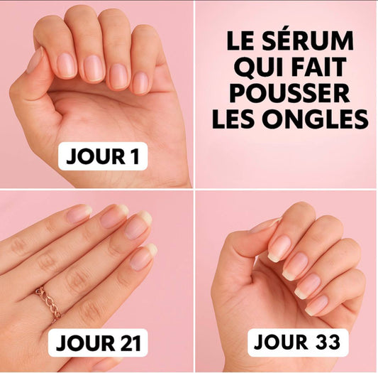 SÉRUM DE CROISSANCE DES ONGLES (1 ACHETÉ = 1 OFFERT)